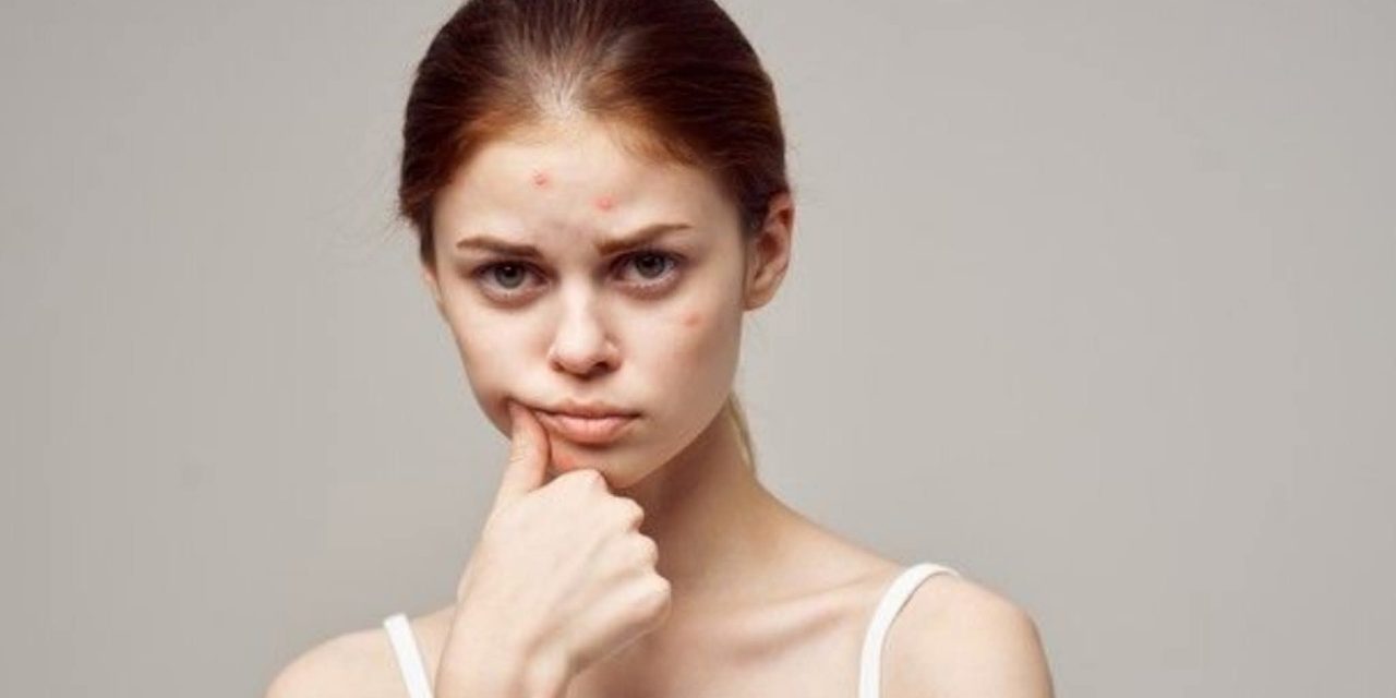 Layanan Kami: KONTRASEPSI BIKIN KULIT IRITASI