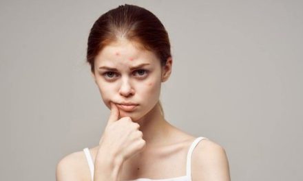 Layanan Kami: KONTRASEPSI BIKIN KULIT IRITASI